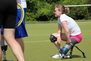 Cesta za přítelem skončila pro Sáru (20) tragicky: Buď vám vezmeme nohu, nebo zemřete, řekli lékaři